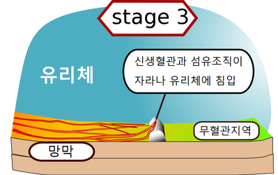 stage 3.png
