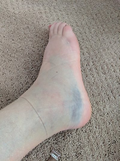 ankle.jpg