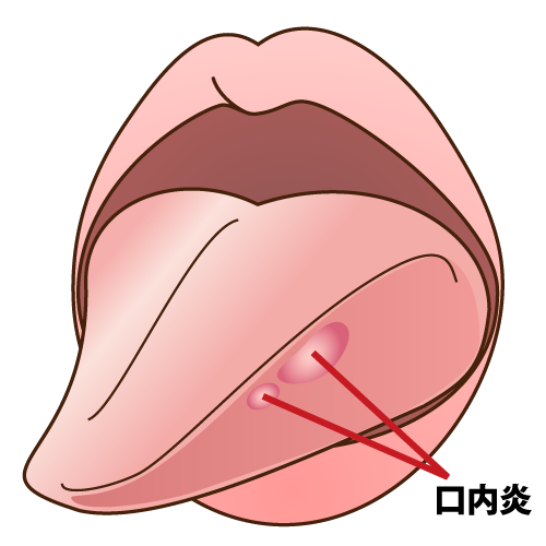 スパイスで健康