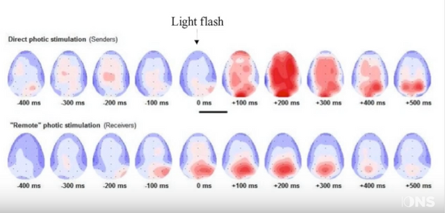 image of brain maps