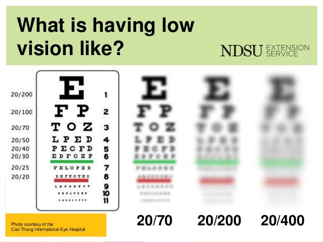 20/40 Vision: What Does It Mean & Is It Bad?