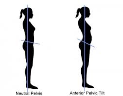 Anterior Pelvic Tilt & Neutral Pelvic Tilt