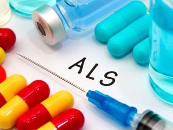 ALS: Immune cells may slow disease progression