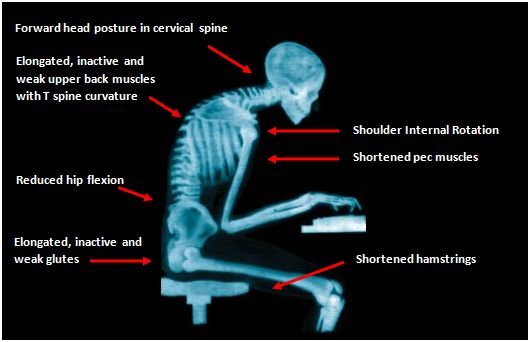 Death By Sitting How A Desk Job Impacts Your Posture And Your