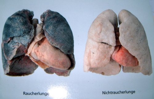 Mit dem Rauchen aufhören wegen der Lunge Unterschiedliche Lungen
