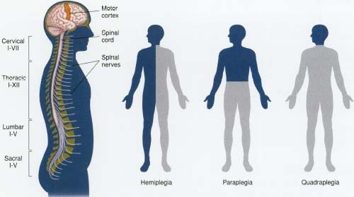 types-of-paralysis-steemit