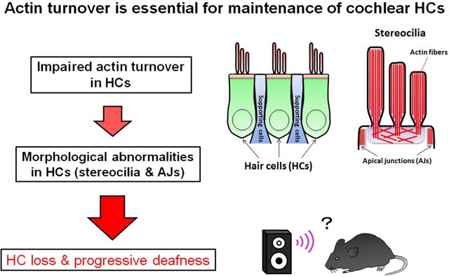 Sensorineural hearing loss