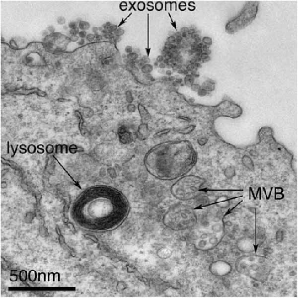 exosomes