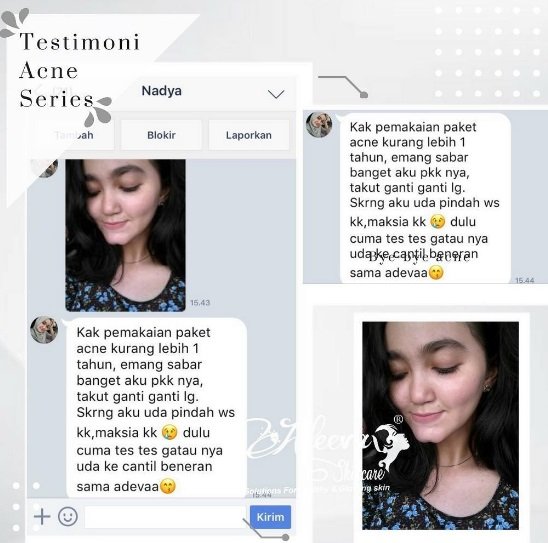 testimoni adeeva