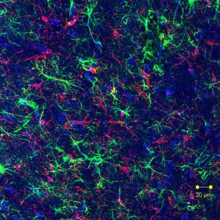 Astrocytes_Microglia-SMTS-NEWS-WEBaf01d.jpg