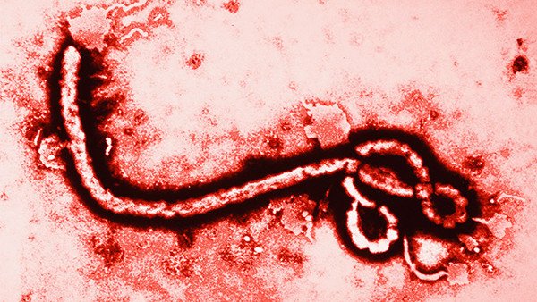 Der angebliche Ebola Virus