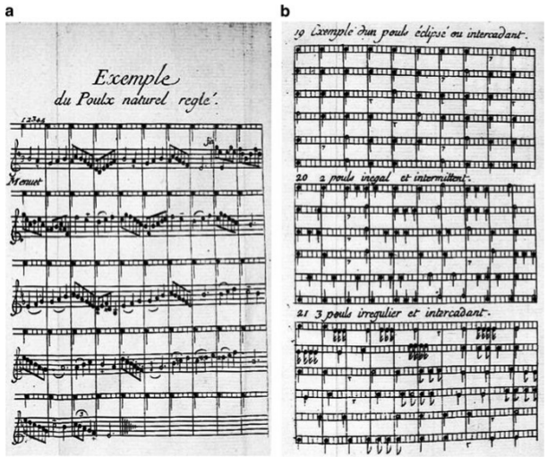 Hearbeat drawn as musical nodes