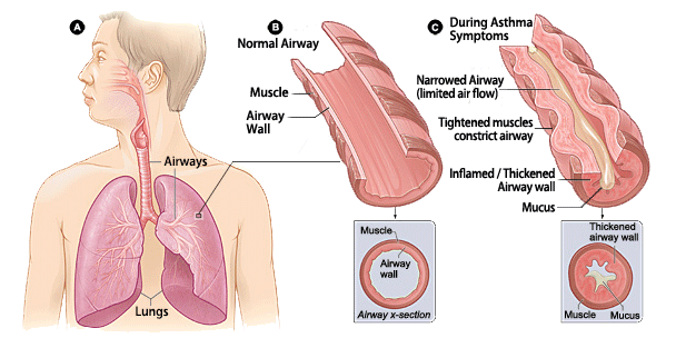 Image of Lungs