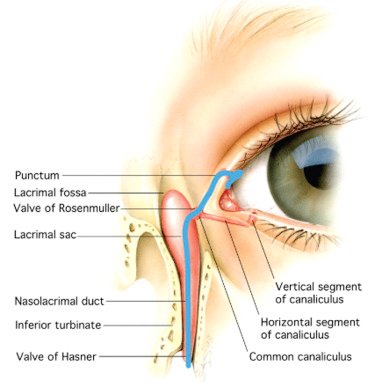 nasolacrimal duct obstruction
