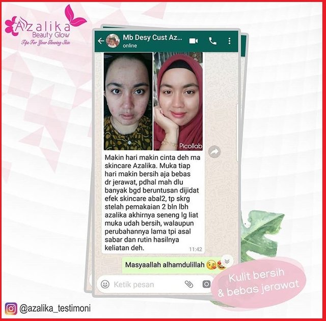 testimoni azalika acne series 2018