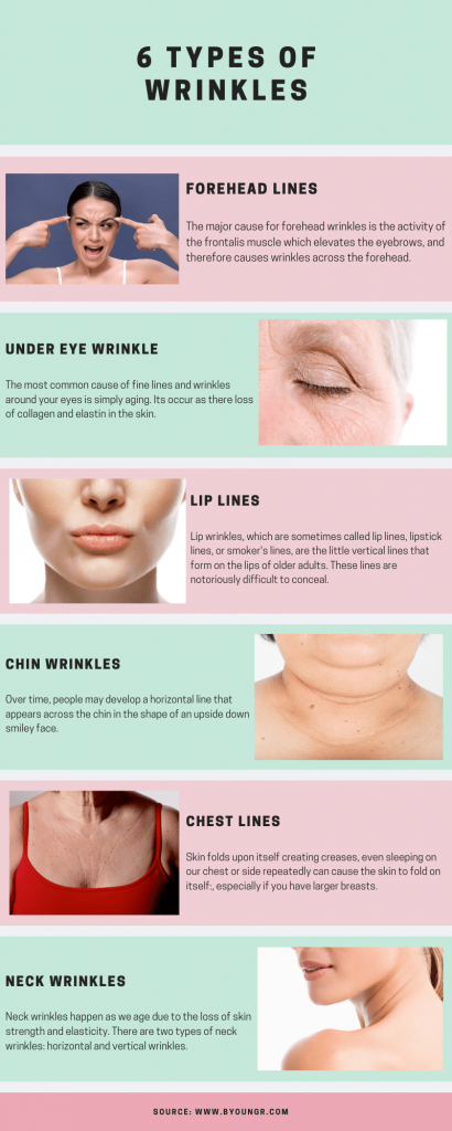 wrinkle types infographic