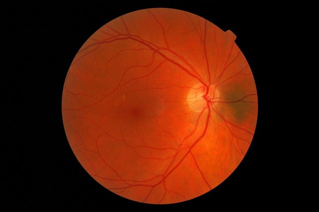 retina.jpg