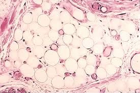 Fat stored in adipose cells,
