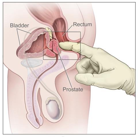 Prostate Diagram