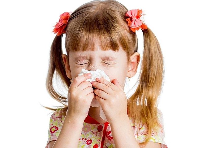 allergic rhinitis