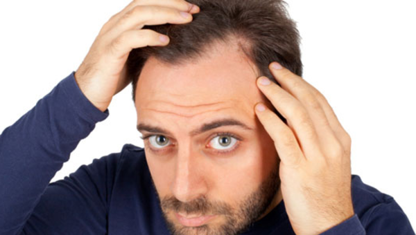 hair loss