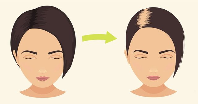 hair loss