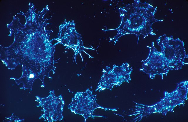 cancer-cells-541954_1920.jpg