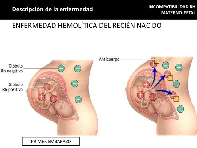 incompatibilidad-rh-materno-fetal-15-728.jpg