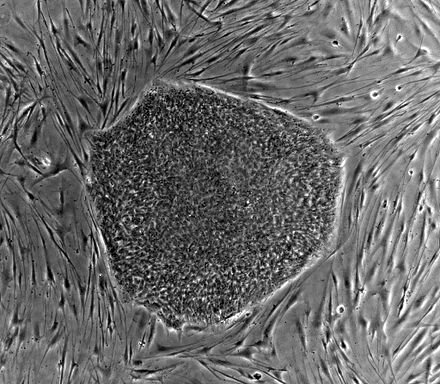 440px-Human_embryonic_stem_cell_colony_phase.jpg