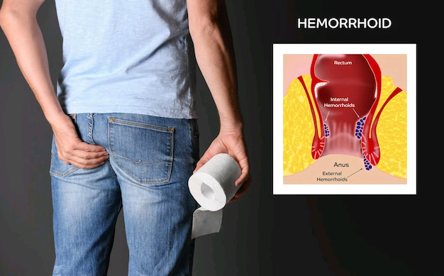 man-with-toilet-paper-suffering-from-hemorrhoid-pain-black-background-closeup-illustration-unhealthy-lower-rectum_495423-32336.jpg