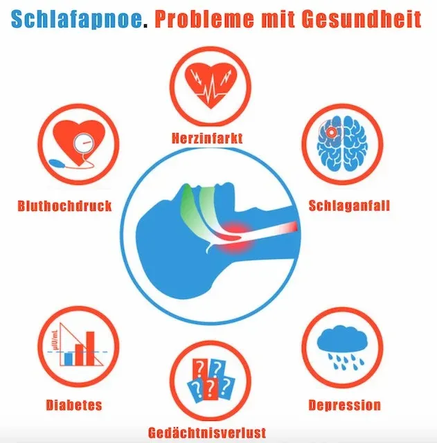 schlafapnoe.webp