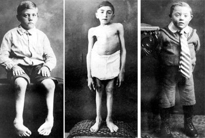 Nazi-Euthanasia-Victims.jpg