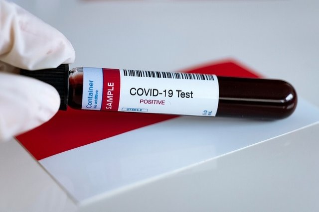 kenali-apa-itu-rapid-test-untuk-virus-corona-1-alodokter.jpg