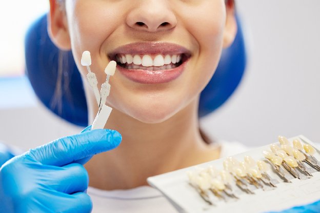 how-to-choose-the-best-dentist-for-porcelain-veneers-in-katy.jpg