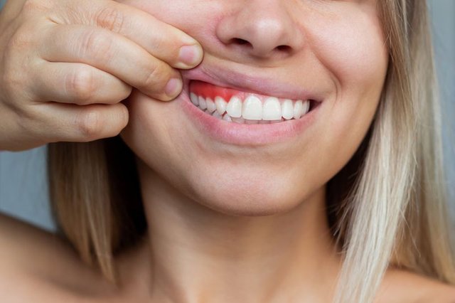 5 Signs It's Time to Consider Gum Graft Surgery.jpg