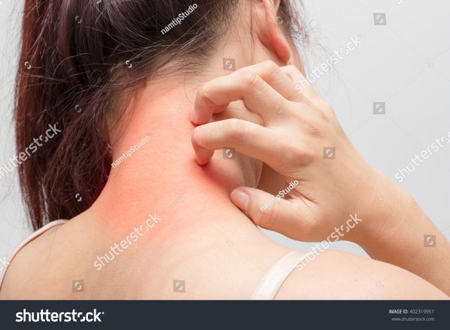 stock-photo-women-scratch-the-itch-with-hand-concept-with-healthcare-and-medicine-402319951.jpg