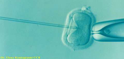 art insemination2 ICSI intracytoplasmic_sperm_injection Dr Elena Kontogianni CC0.png