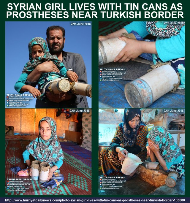 Syrian girl lives with tin cans as prostheses near Turkish border v2-01.jpg