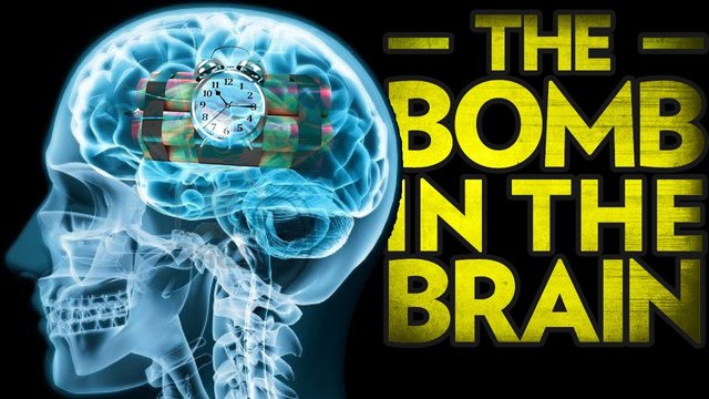 FDR_5060_bomb_in_the_brain_all.jpg