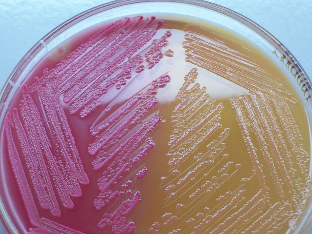 1280px-MacConkey_agar_with_LF_and_LF_colonies.jpg