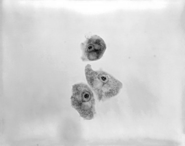 free-living-amoebae-belonging-to-the-genera-acanthamoeba-balamuthia-and-naegleria-690x544.jpg