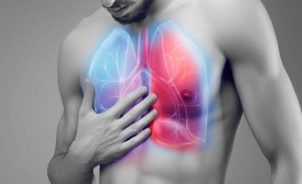 lungs-1911260410.jpg