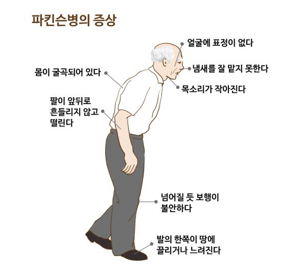 네이버 지식백과 파킨슨병-1.jpg