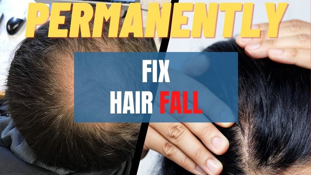 fix hair Fall (1).jpg