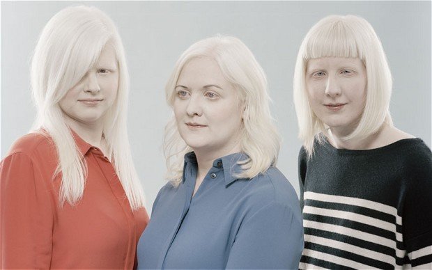 albinos.jpg