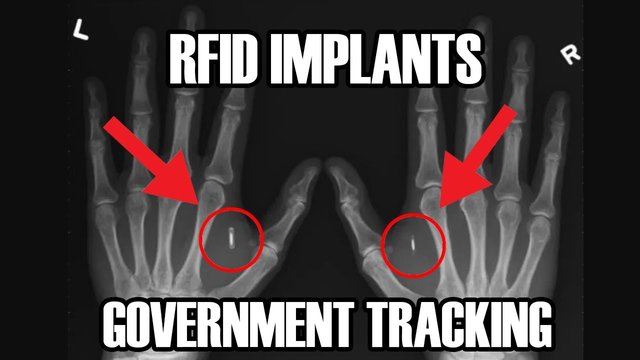 RFID Chip Implants — Government tracking.jpg