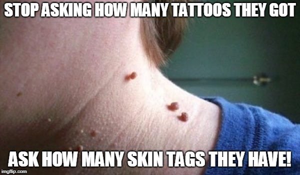 Skin-tags-600x350.jpg