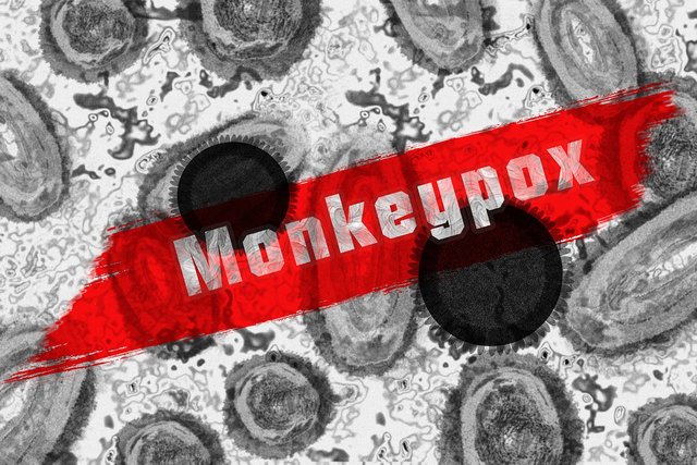monkey-pox-7217582_1280.jpg
