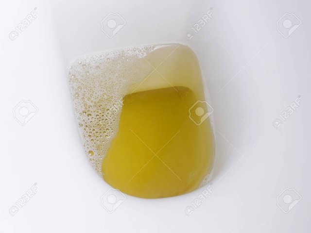 147009548-closeup-urine-or-pee-in-the-toilet-bowl.jpg