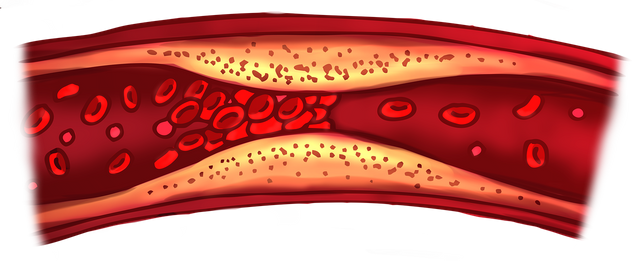 blood-clot-7118517_1280.png